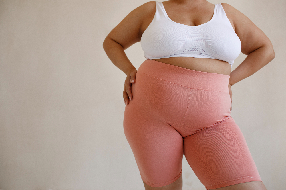 Living with Lipedema: Challenges and Ways to Overcome Them