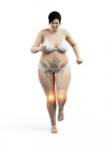 Joint Pain Lipedema